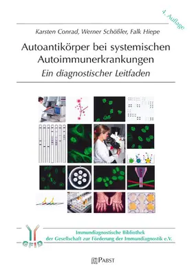 Conrad / Schößler / Karsten |  Autoantikörper bei systemischen Autoimmunerkrankungen | eBook | Sack Fachmedien