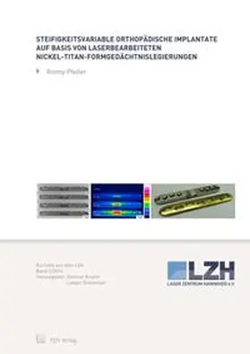 Pfeifer |  Steifigkeitsvariable orthopädische Implantate auf Basis von laserbearbeiteten Nickel-Titan-Formgedächtnislegierungen | Buch |  Sack Fachmedien