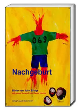  Nachgeburt | Buch |  Sack Fachmedien