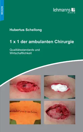 Schellong |  1x1 der ambulanten Chirurgie | eBook | Sack Fachmedien