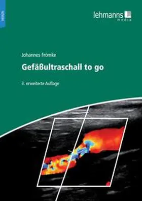 Frömke |  Gefäßultraschall to go | Buch |  Sack Fachmedien