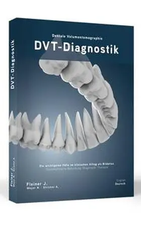 Fleiner / Weyer / Stricker |  DVT-Diagnostik | Buch |  Sack Fachmedien