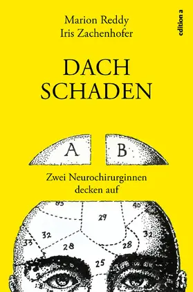 Zachenhofer / Reddy |  Dachschaden | eBook | Sack Fachmedien