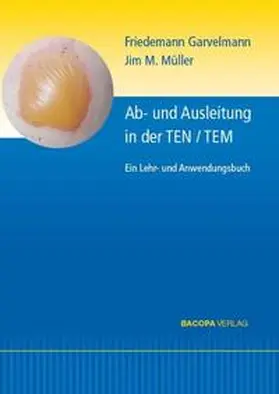 Garvelmann / Müller |  Ab- und Ausleitungsverfahren in der TEN/TEM. | Buch |  Sack Fachmedien