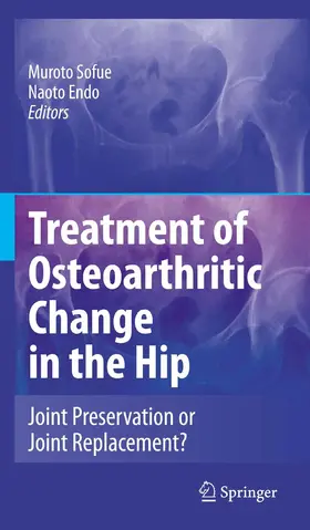 Sofue / Endo | Treatment of Osteoarthritic Change in the Hip | E-Book | sack.de