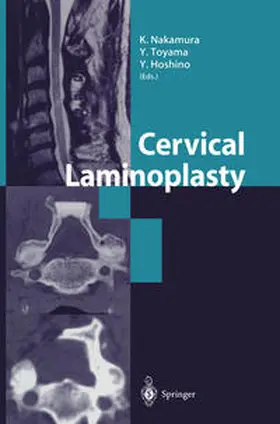 Nakamura / Toyama / Hoshino |  Cervical Laminoplasty | eBook | Sack Fachmedien