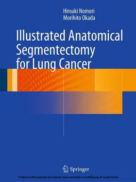 Nomori / Okada | Illustrated Anatomical Segmentectomy for Lung Cancer | E-Book | sack.de