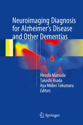 Matsuda / Asada / Tokumaru | Neuroimaging Diagnosis for Alzheimer's Disease and Other Dementias | E-Book | sack.de