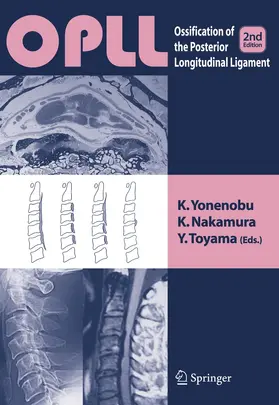 Yonenobu / Toyama / Nakamura |  OPLL | Buch |  Sack Fachmedien