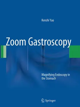 Yao |  Zoom Gastroscopy | Buch |  Sack Fachmedien