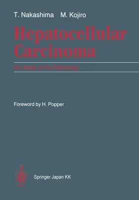 Nakashima / Kojiro |  Hepatocellular Carcinoma | Buch |  Sack Fachmedien