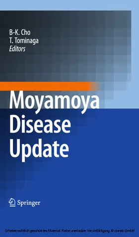 Cho / Tominaga | Moyamoya Disease Update | E-Book | www2.sack.de