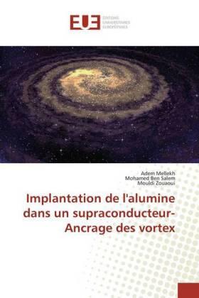 Mellekh / Ben Salem / Zouaoui |  Implantation de l'alumine dans un supraconducteur-Ancrage des vortex | Buch |  Sack Fachmedien