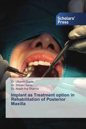 Gupta / Saran / Sharma |  Implant as Treatment option in Rehabilitation of Posterior Maxilla | Buch |  Sack Fachmedien