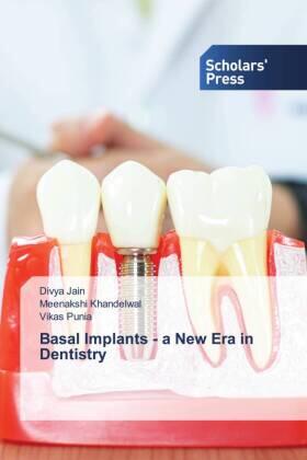 Jain / Khandelwal / Punia |  Basal Implants - a New Era in Dentistry | Buch |  Sack Fachmedien