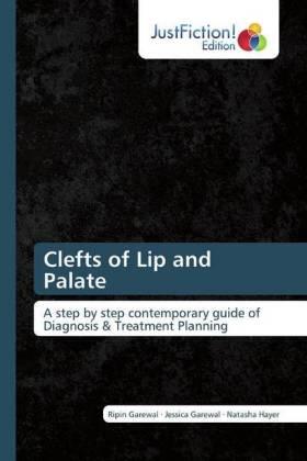 Garewal / Hayer |  Clefts of Lip and Palate | Buch |  Sack Fachmedien