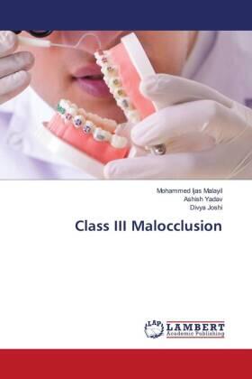 Malayil / Yadav / Joshi |  Class III Malocclusion | Buch |  Sack Fachmedien