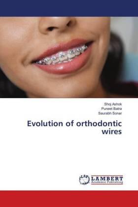 Ashok / Batra / Sonar |  Evolution of orthodontic wires | Buch |  Sack Fachmedien