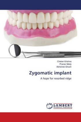 Krishna / Mody / Ghosh |  Zygomatic implant | Buch |  Sack Fachmedien