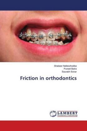 Nallatuthodika / Batra / Sonar |  Friction in orthodontics | Buch |  Sack Fachmedien