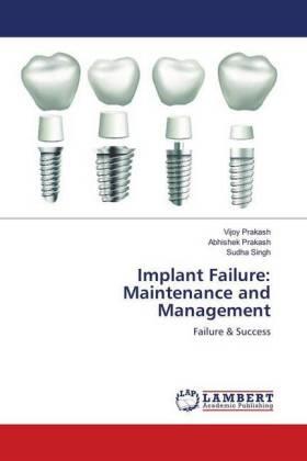 Prakash / Singh |  Implant Failure: Maintenance and Management | Buch |  Sack Fachmedien