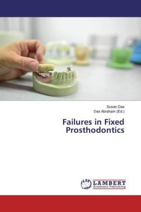 Dax / Abraham |  Failures in Fixed Prosthodontics | Buch |  Sack Fachmedien
