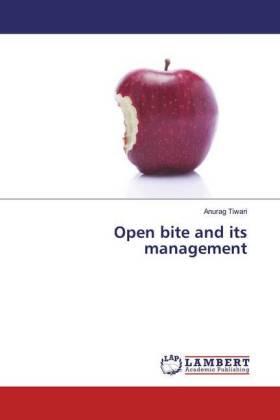 Tiwari |  Open bite and its management | Buch |  Sack Fachmedien
