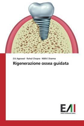 Agrawal / Chopra / Sharma |  Rigenerazione ossea guidata | Buch |  Sack Fachmedien