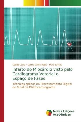 Costa / Regis / Santos |  Infarto do Miocárdio visto pelo Cardiograma Vetorial e Espaço de Fases | Buch |  Sack Fachmedien