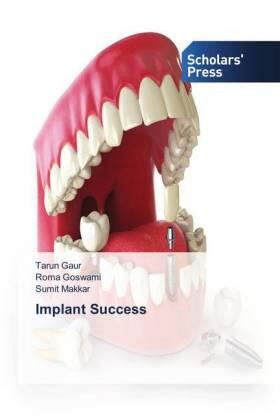 Gaur / Goswami / Makkar |  Implant Success | Buch |  Sack Fachmedien