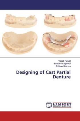 Rawat / Agarwal / Sharma |  Designing of Cast Partial Denture | Buch |  Sack Fachmedien