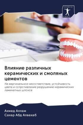 Allam / Abd Alwahab |  Vliqnie razlichnyh keramicheskih i smolqnyh cementow | Buch |  Sack Fachmedien