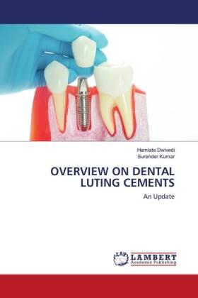 Dwivedi / Kumar |  OVERVIEW ON DENTAL LUTING CEMENTS | Buch |  Sack Fachmedien