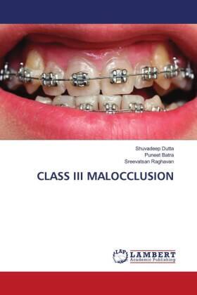 Dutta / Batra / Raghavan |  CLASS III MALOCCLUSION | Buch |  Sack Fachmedien