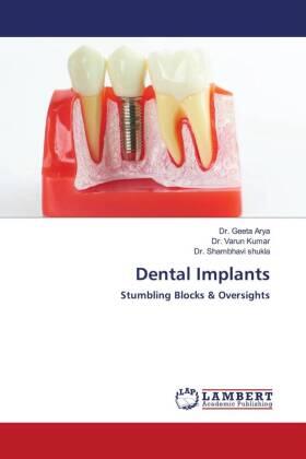 Arya / Kumar / Shukla |  Dental Implants | Buch |  Sack Fachmedien