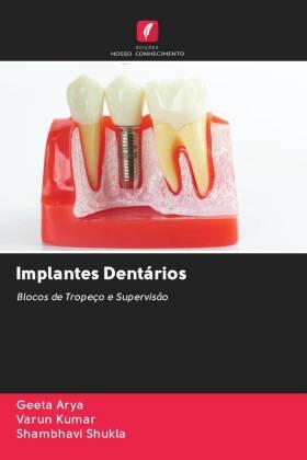 Arya / Kumar / Shukla |  Implantes Dentários | Buch |  Sack Fachmedien