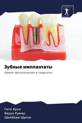 Ar'q / Kumar / Shukla |  Zubnye implantaty | Buch |  Sack Fachmedien