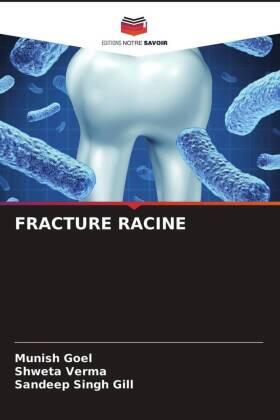 Goel / Verma / Gill |  FRACTURE RACINE | Buch |  Sack Fachmedien