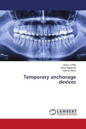 Pillai / Aggarwal / Misra |  Temporary anchorage devices | Buch |  Sack Fachmedien