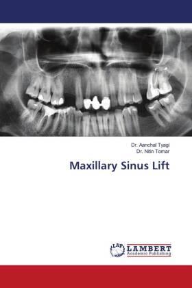 Tyagi / Tomar |  Maxillary Sinus Lift | Buch |  Sack Fachmedien