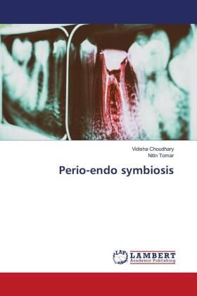 Choudhary / Tomar |  Perio-endo symbiosis | Buch |  Sack Fachmedien