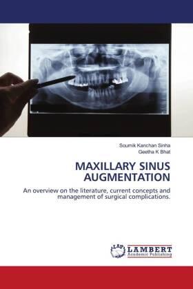 Sinha / Bhat |  MAXILLARY SINUS AUGMENTATION | Buch |  Sack Fachmedien
