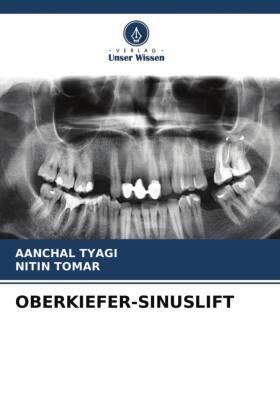 Tyagi / Tomar |  OBERKIEFER-SINUSLIFT | Buch |  Sack Fachmedien