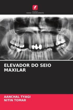 Tyagi / Tomar |  ELEVADOR DO SEIO MAXILAR | Buch |  Sack Fachmedien