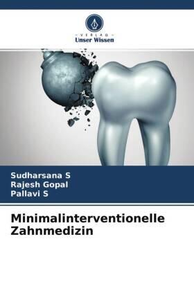 S / Gopal |  Minimalinterventionelle Zahnmedizin | Buch |  Sack Fachmedien
