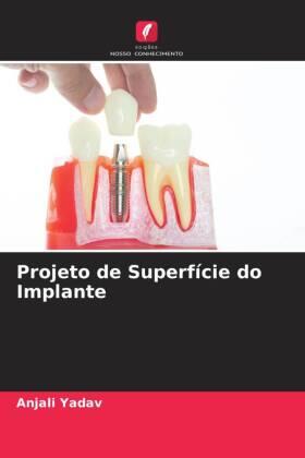 Yadav |  Projeto de Superfície do Implante | Buch |  Sack Fachmedien