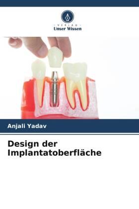 Yadav |  Design der Implantatoberfläche | Buch |  Sack Fachmedien