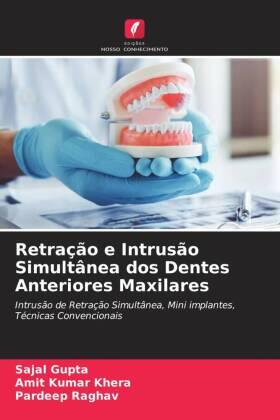 Gupta / Khera / Raghav |  Retração e Intrusão Simultânea dos Dentes Anteriores Maxilares | Buch |  Sack Fachmedien