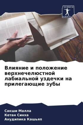 Malla / Sinha / Kash'qp |  Vliqnie i polozhenie werhnechelüstnoj labial'noj uzdechki na prilegaüschie zuby | Buch |  Sack Fachmedien