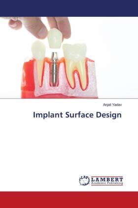 Yadav |  Implant Surface Design | Buch |  Sack Fachmedien